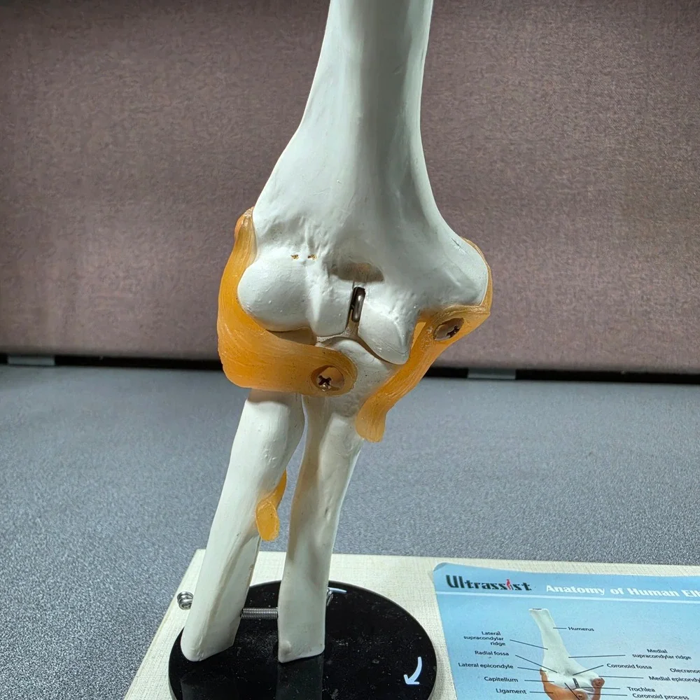 Ultrassist Human Elbow Joint Anatomy Model Life Size White Excellent Ligaments